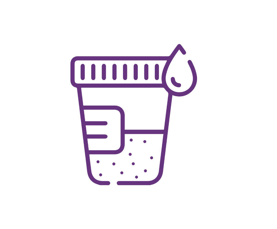 Dark-coloured urine