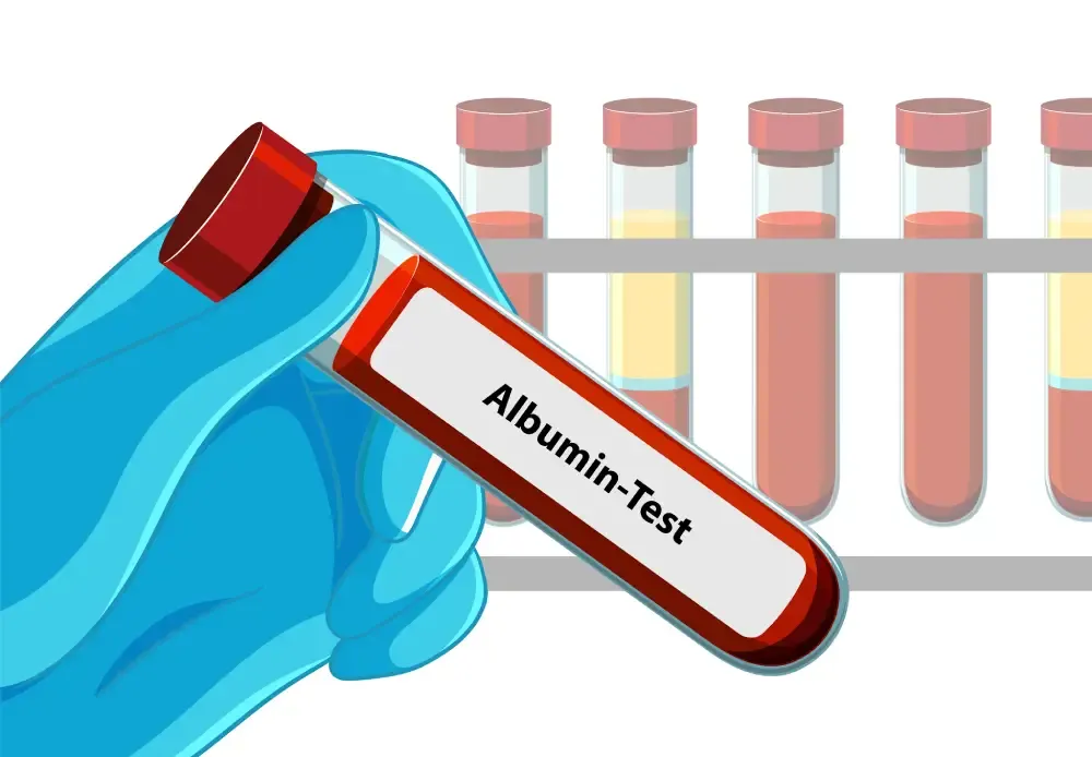 Albumin Blood Test: Normal Range, Procedure & Results