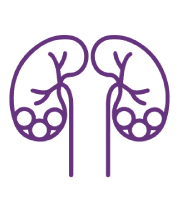 Kidney stones