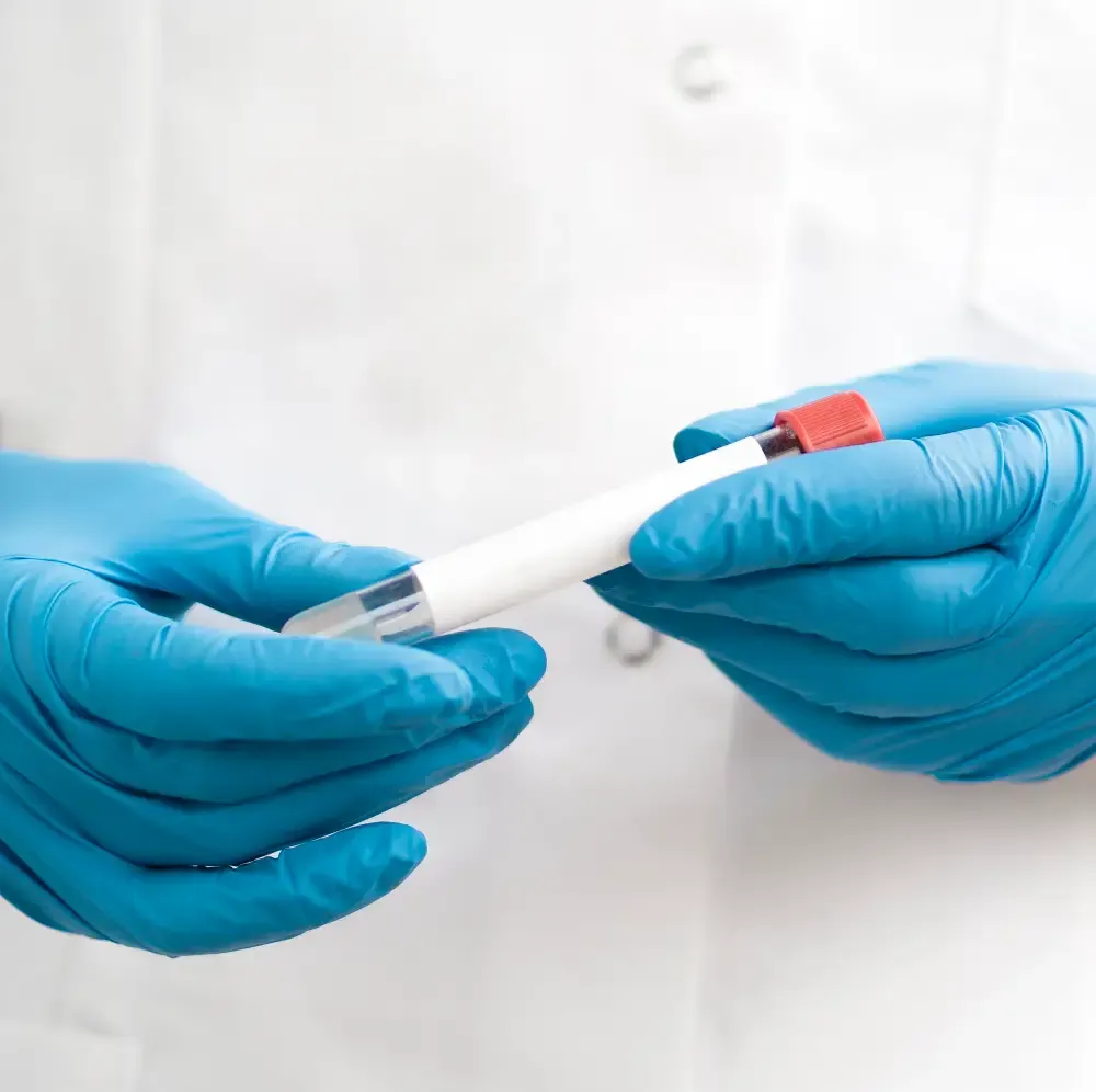 Progesterone Test - Purpose, Procedure, Results Interpretation, Normal Range