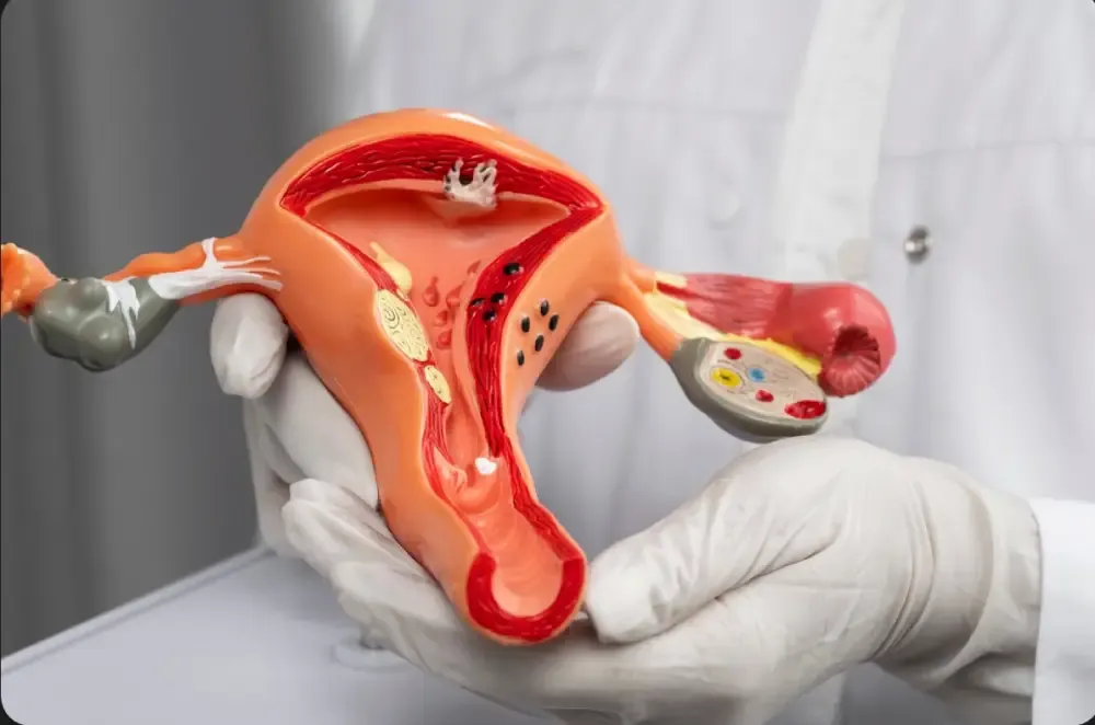 Cervical Cancer: Causes, Symptoms, Diagnosis & Treatment