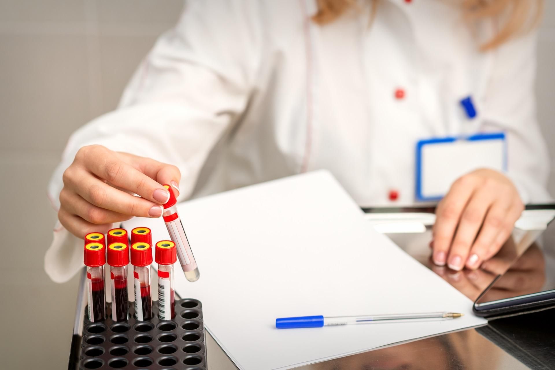 Follicle Stimulating Hormone Test Understanding Fsh Levels By Age