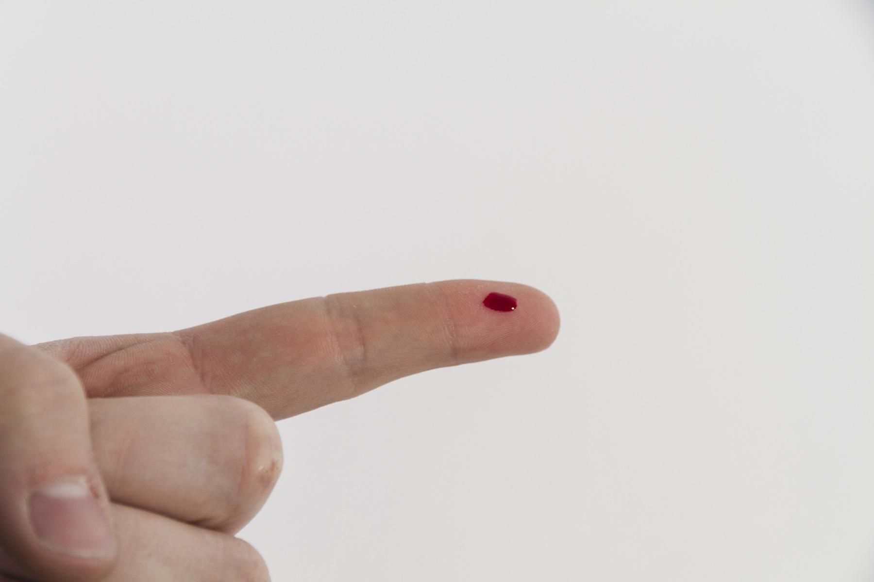 Protein C Activity Normal Range In Blood Test Explained