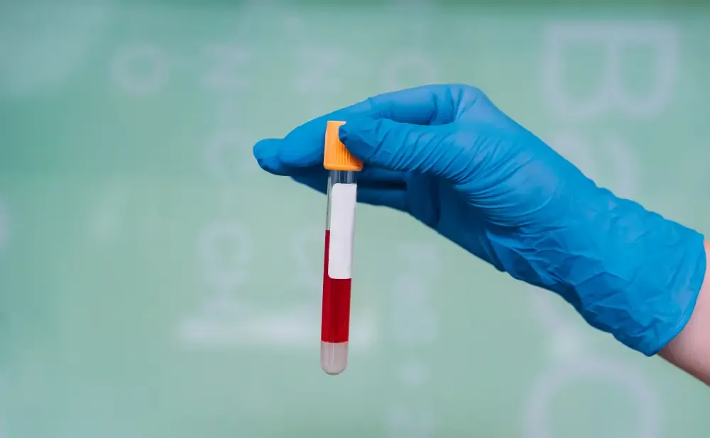 Sodium Blood Test: Uses, Procedure, Normal Range and Test Results