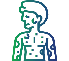 Anaphylaxis