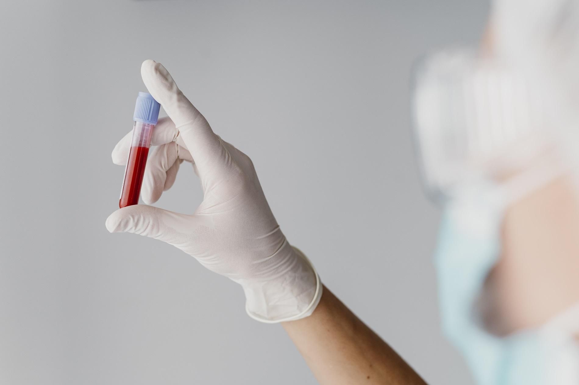 Signs Of Autoimmune Diseases When To Consider An Interleukin 6 Test