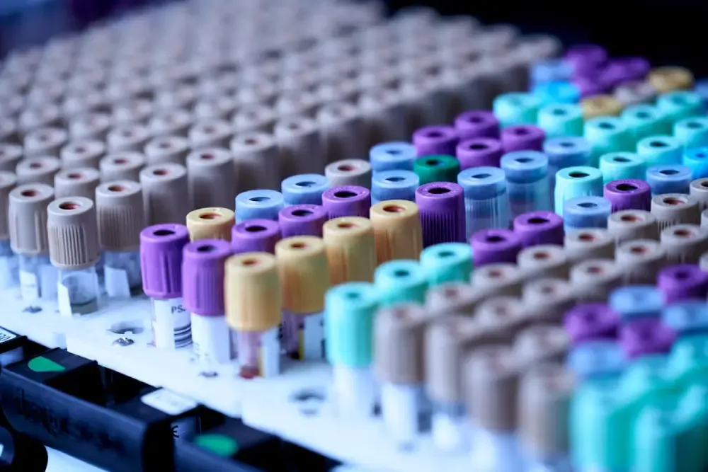 Fasting vs. Non-Fasting Blood Tests: What's the Difference?