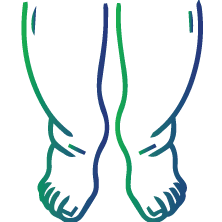 Swelling of feet and ankles