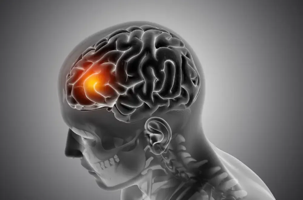 How to Diagnose Brain Fever and Which Test is Required to Check Meningitis?