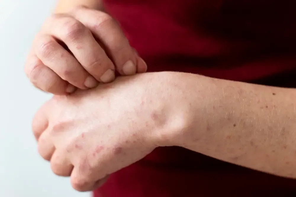 How to Diagnose Chickenpox and Which Test is Required?