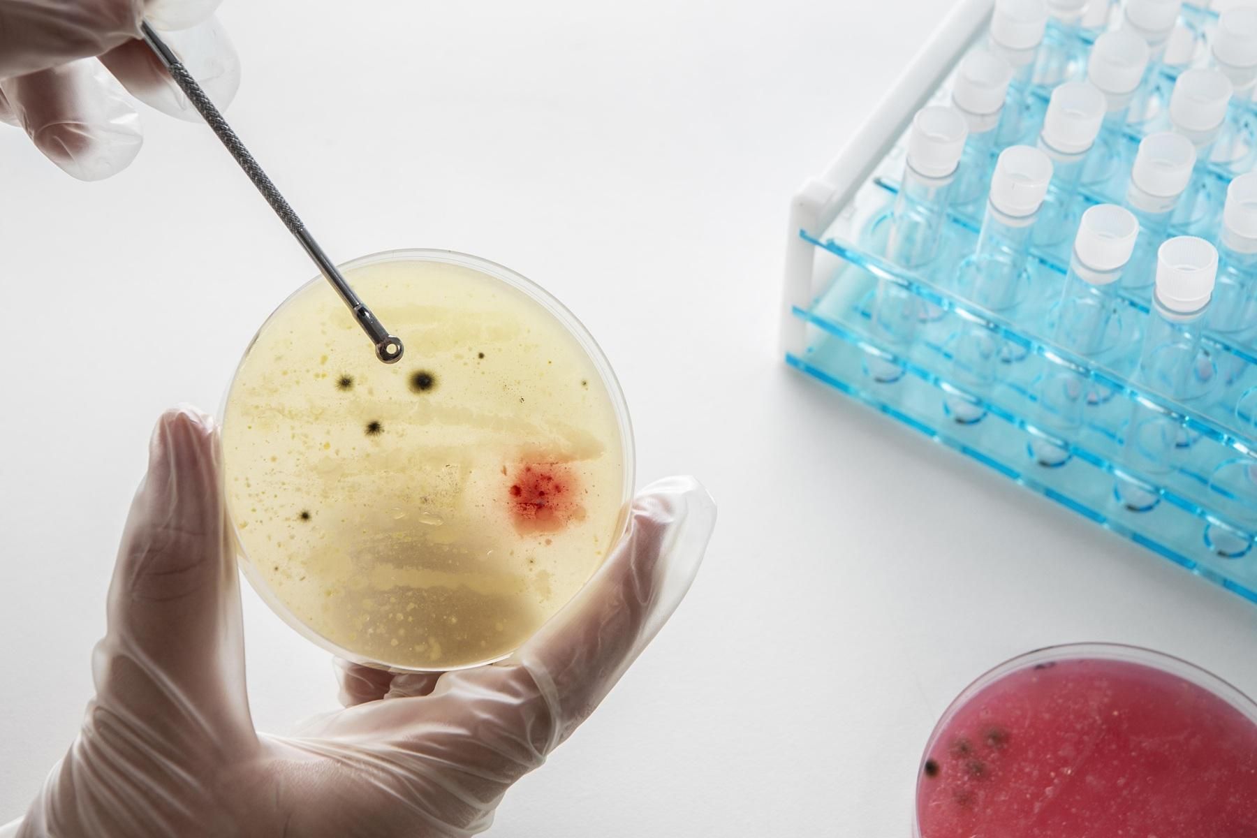 How A Urine Culture And Sensitivity Test Helps Diagnose Infections