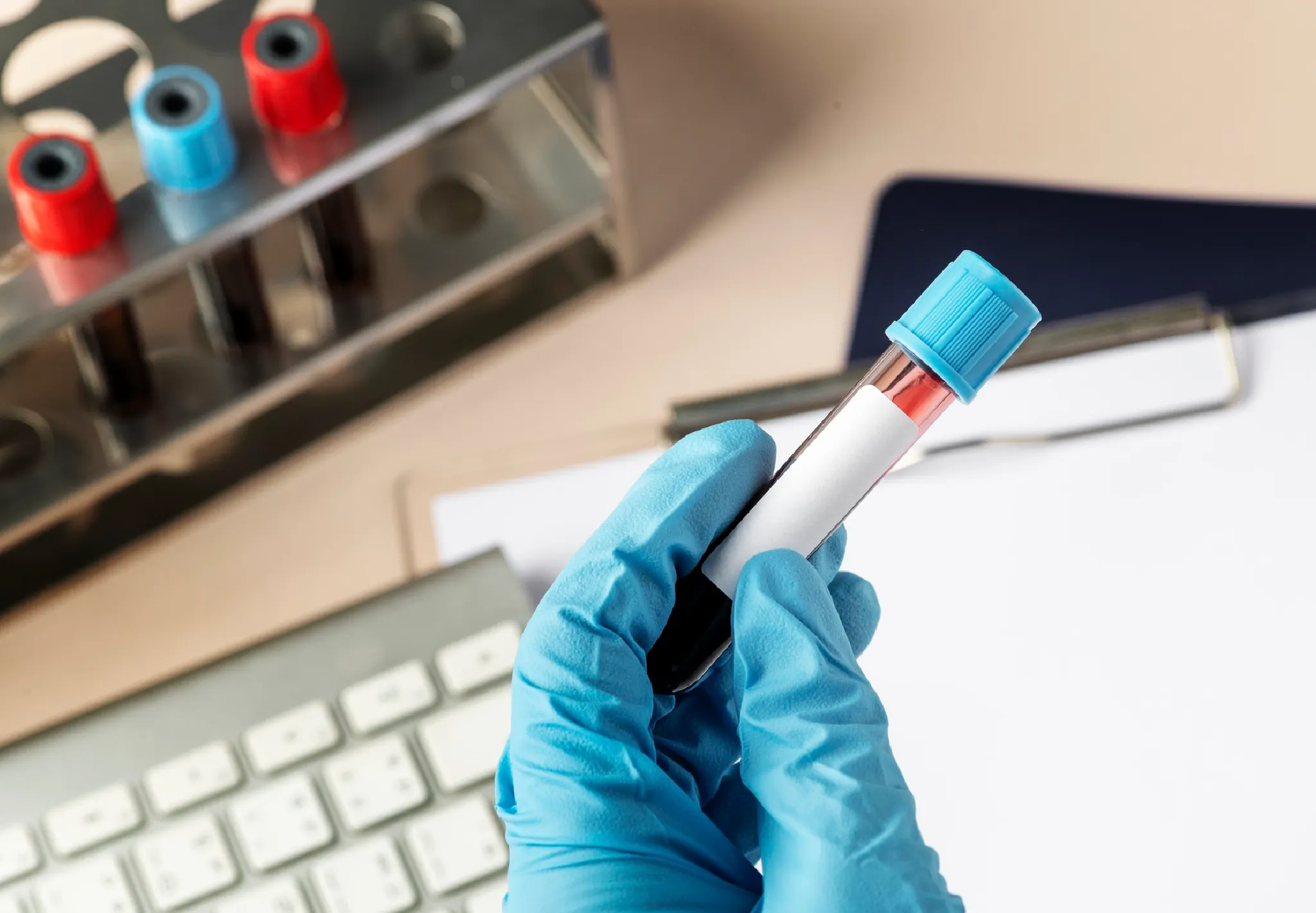 What is Anti-CCP Test and its Uses, Test Results & Normal Range