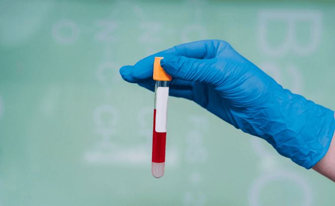 Bilirubin Test Normal Range Explained: What Your Numbers Really Mean