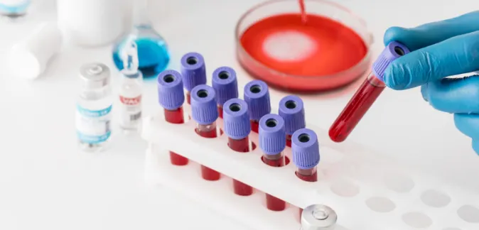 Blood Culture Test - Normal Range, Procedure, and Results