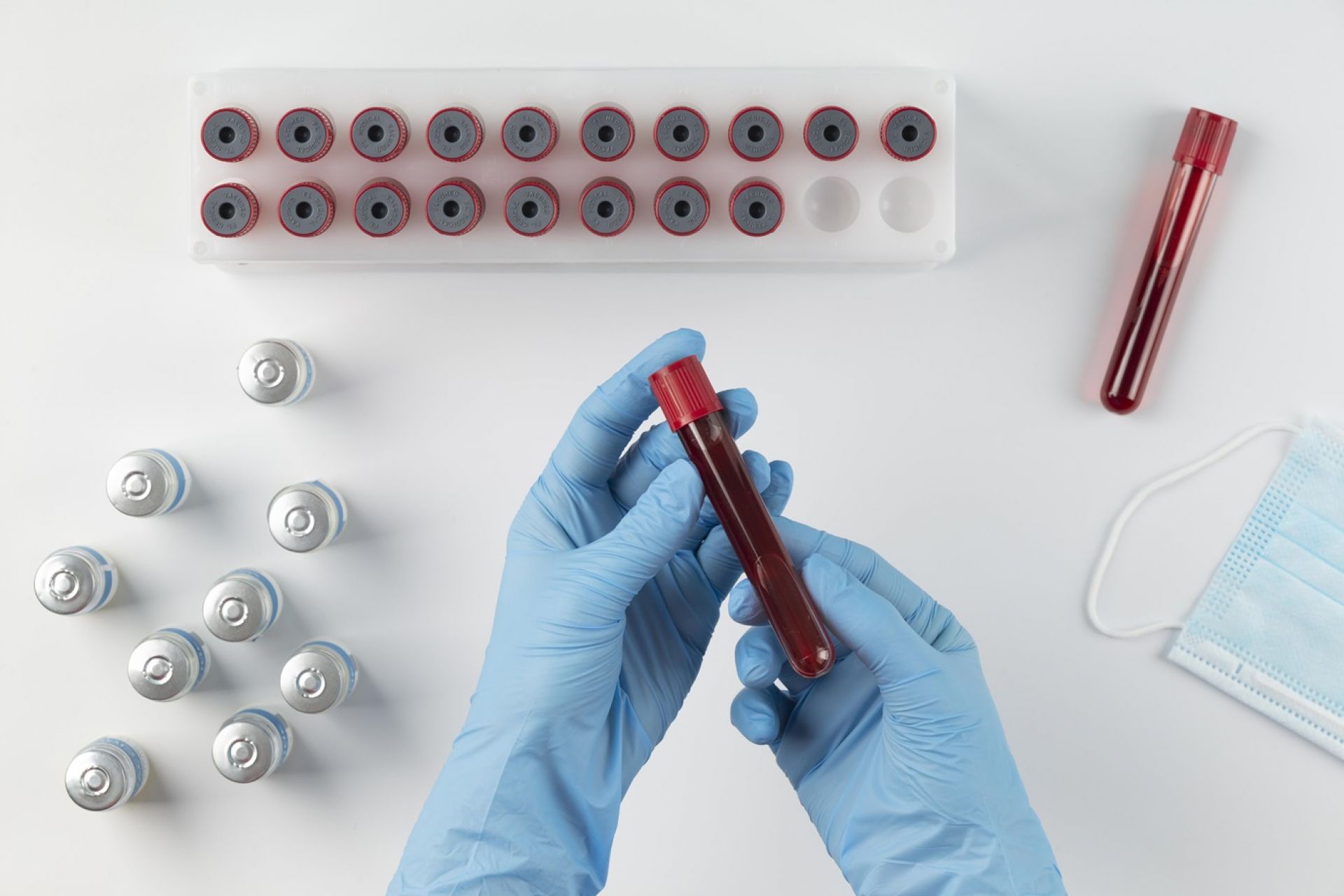 Abnormal Hemoglobin: The Role of Hb Electrophoresis