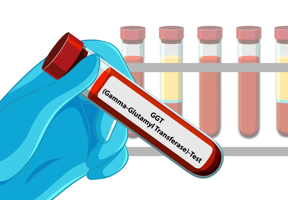 Gamma-Glutamyl Transferase (GGT) Test – Normal Range, Purpose, Procedure, And Results Interpretation