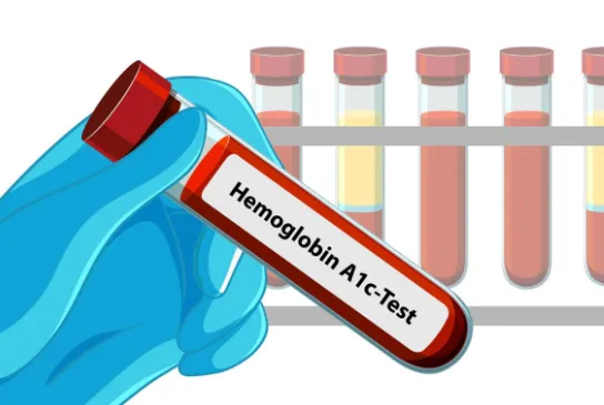 HbA1c Test: Purpose, Procedure, Normal Range & Results