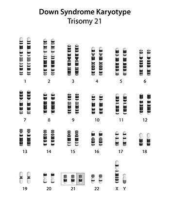Next Generation Sequencing What You Should Know About Prenatal Aneuploidy Screening