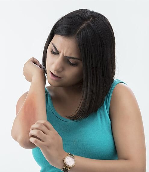 Can Allergies Worsen Diabetes