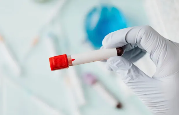 Karyotype Blood Test: Purpose, Procedure, Normal Range, and Test Results Mean