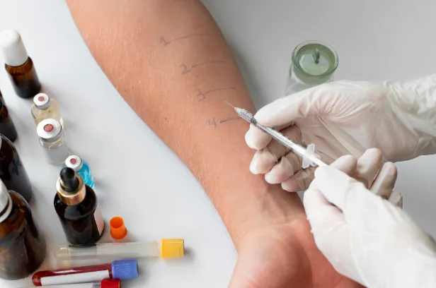 Mantoux Test - Price, Normal Range, Purpose and Results