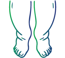Swelling (edema) in the legs, feet, or face