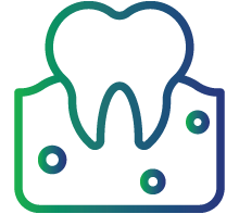 Chronic gum inflammation (gingivitis)