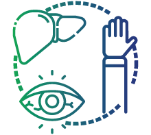 Jaundice (yellowing of skin and eye white)