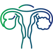 Polycystic Ovarian Syndrome (PCOS)
