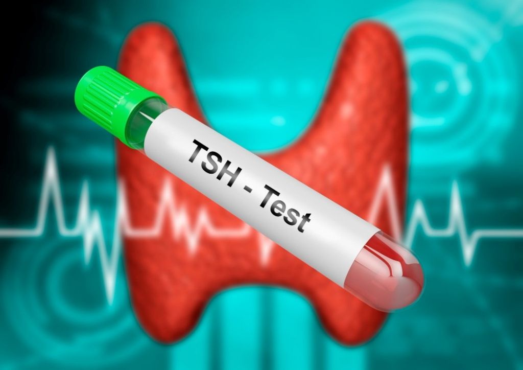 TSH Normal Range Explained: What Normal TSH Levels Really Mean by Age, Gender, and Life Stage