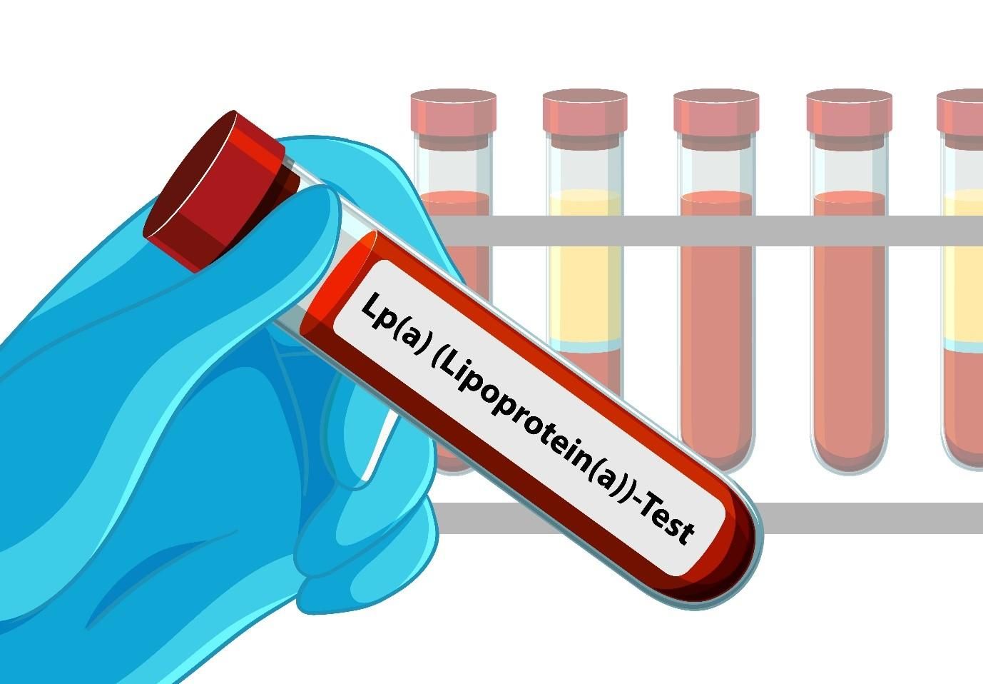 How To Know The Symptoms Of High Lipoprotein A Warning Signs And Risk Factors