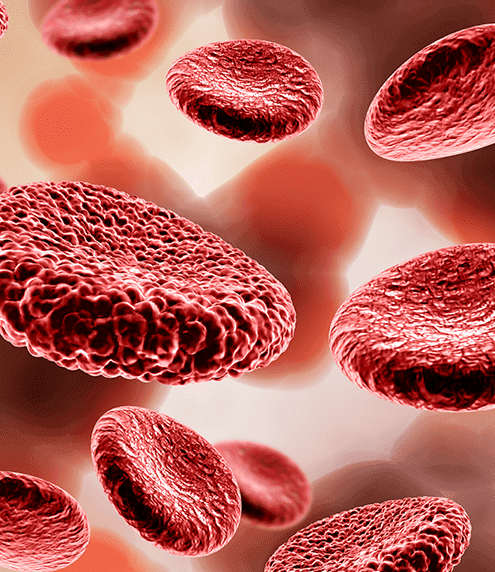 Antiphospholipid Syndrome And Its Diagnosis