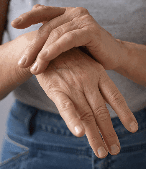 Sjogren's syndrome - Symptoms, diagnosis & treatment