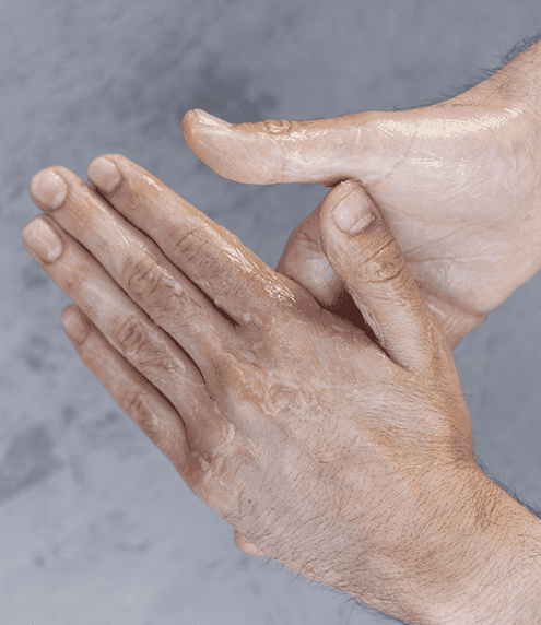 Scleroderma: Diagnoses and Tests