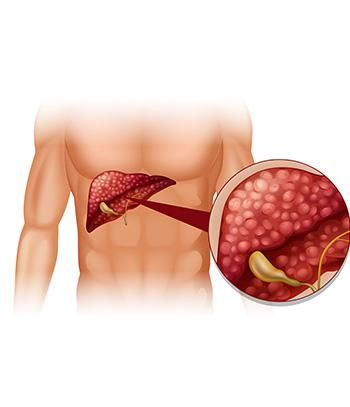 Know More About Liver Function Tests